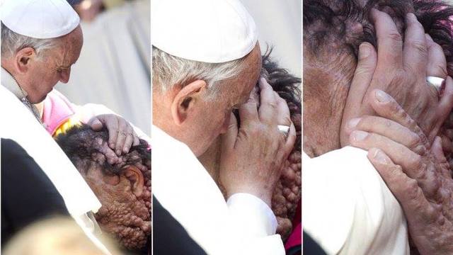Папа пригорнув чоловіка із деформованим обличчям