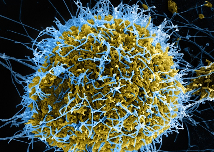 вірус Ебола