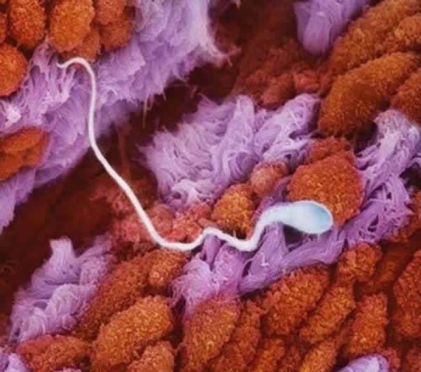 Сперматозоїд у матковій трубі