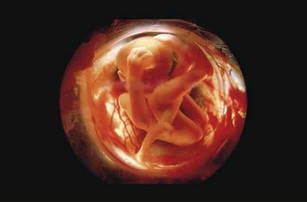 ембріон 26 тижнів